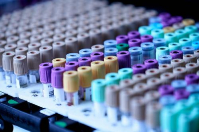 15-19-летние в группе высокой смертности от хантавируса